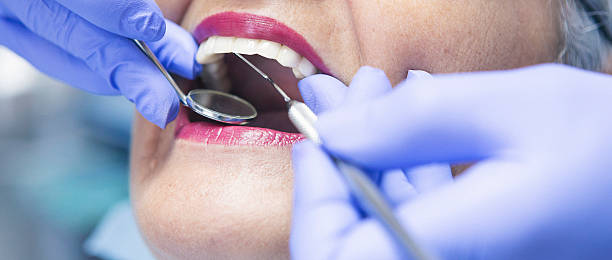 Best Emergency Dentist for Knocked-Out Tooth in USA